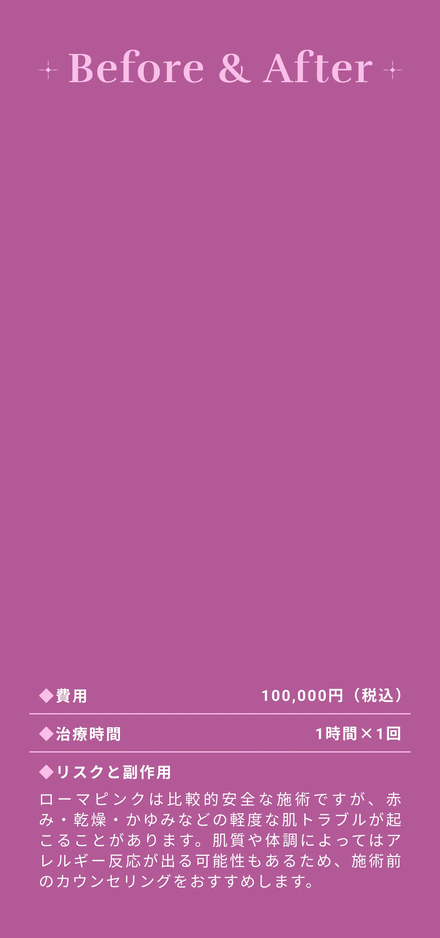 ローマピンクのビフォーアフター見出し