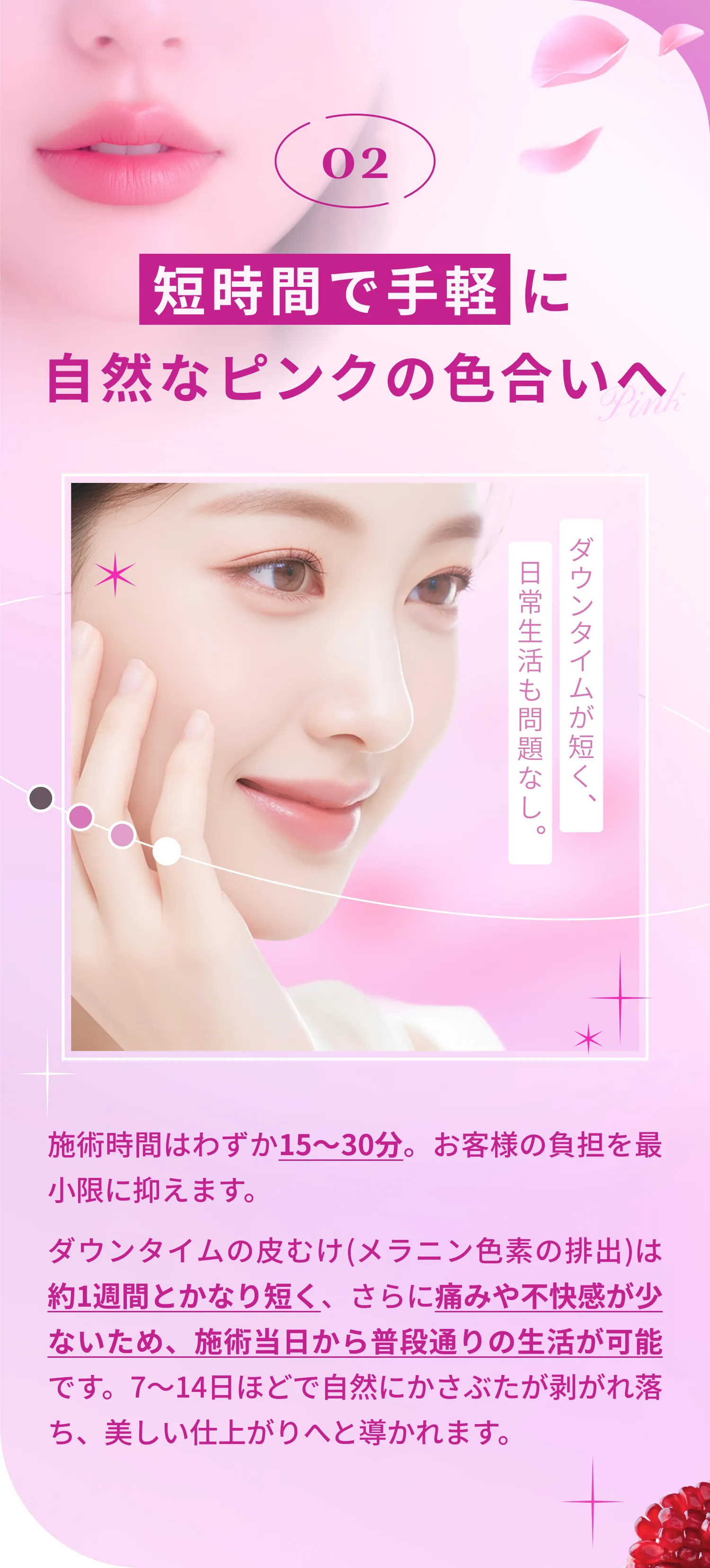 ポイント2 ダウンタイム配慮