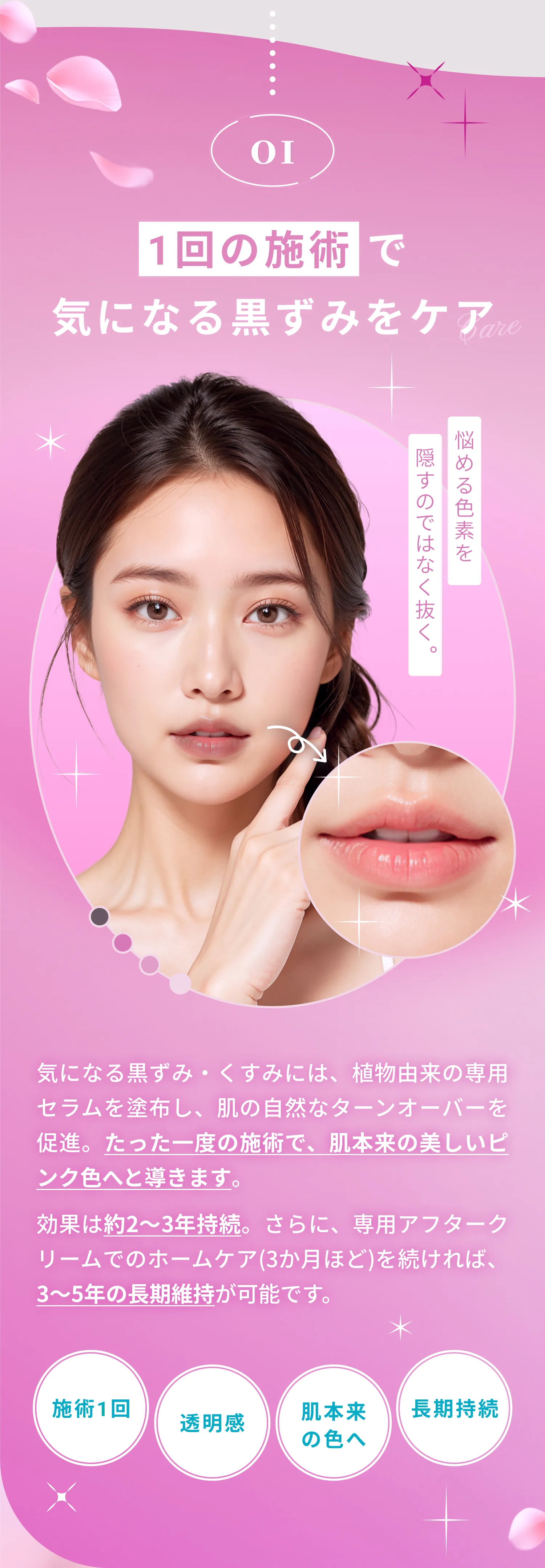 ポイント1 歯ぐきの色ムラ改善