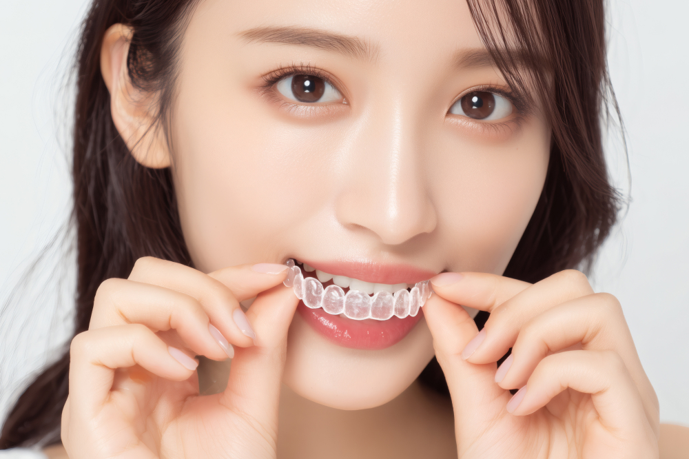 3Dデジタルマウスピース矯正