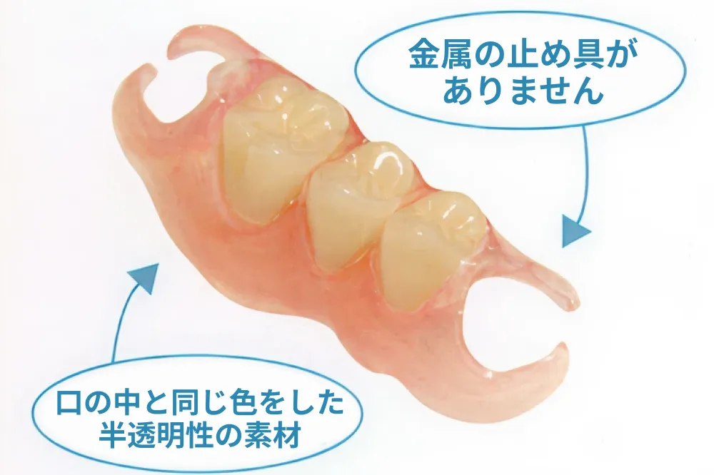 ノンクラスプデンチャー