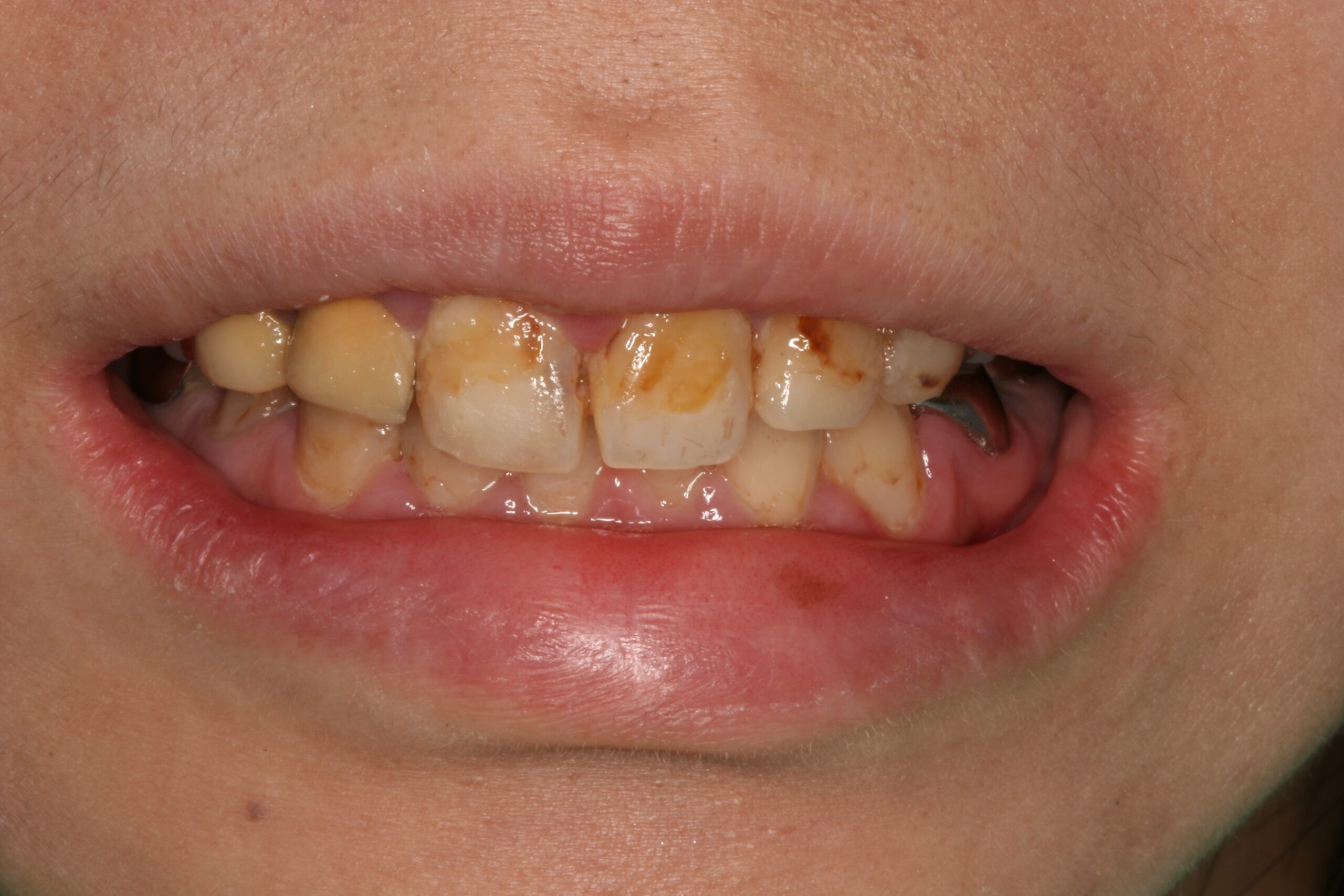 丸の内帝劇デンタルクリニックがキレイレポートに掲載されました