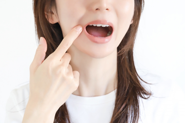 すきっ歯の原因を確認するイメージ